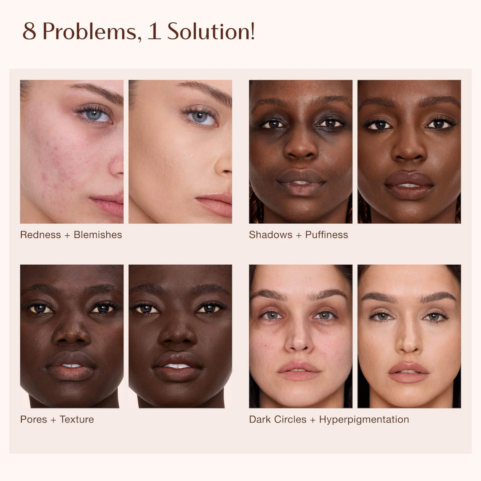 Консилер Charlotte Tilbury Airbrush Flawless Crease-Proof Long-Wear Blur Concealer with Hyaluronic Acid у відтінку 4.5 Fair-Medium Консилер Charlotte Tilbury Airbrush Flawless Crease-Proof Long-Wear Blur Concealer with Hyaluronic Acid у відтінку 4.5 Fair-Medium